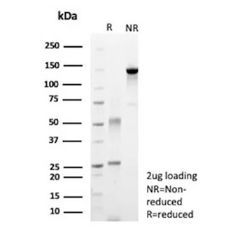 Recombinant Carbonic Anhydrase 9 Antibody / CA9