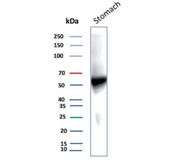 Recombinant Carbonic Anhydrase IX Antibody / CA9