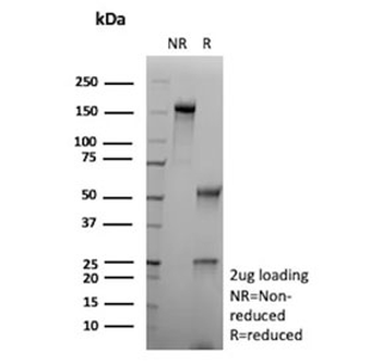 Recombinant Carbonic Anhydrase IX Antibody / CA9