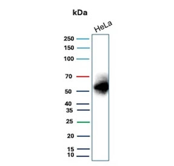 Recombinant Carbonic Anhydrase IX Antibody / CA9