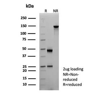 CD161 Antibody / KLRB1