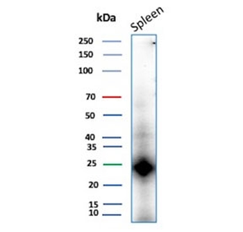 CD161 Antibody / KLRB1
