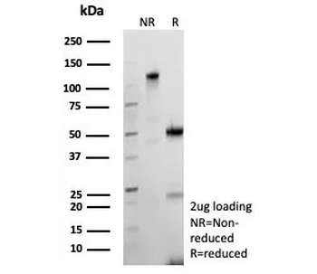 Recombinant Bcl-X Antibody