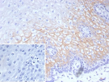 Recombinant Desmocollin-2/3 Antibody