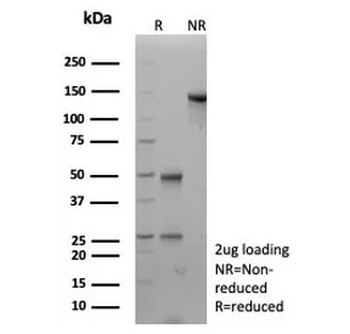 Recombinant Desmocollin-2/3 Antibody
