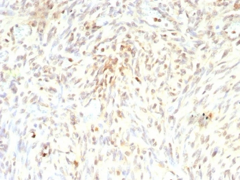 Recombinant MDM2 Antibody
