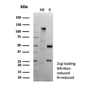 Recombinant CD151 Antibody
