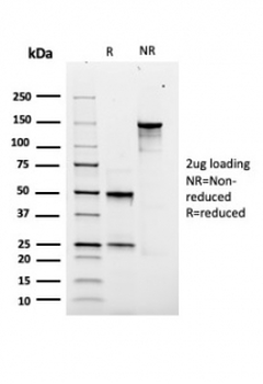 Recombinant SOX9 Antibody / SRY-box 9