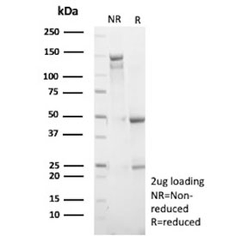 Recombinant MKI67 Antibody / Ki-67