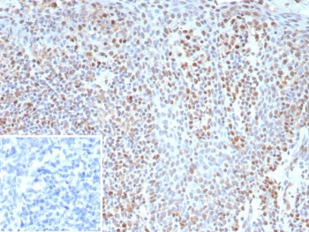 Recombinant Bcl-6 Antibody