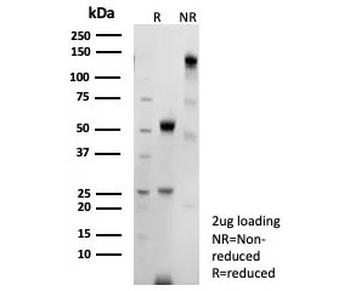 Recombinant Bcl-6 Antibody