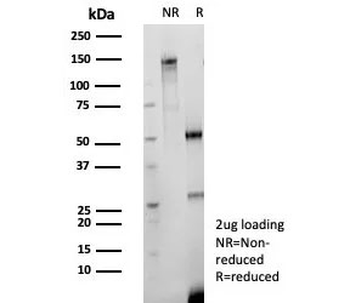 Recombinant CD147 Antibody / Emmprin / Basigin