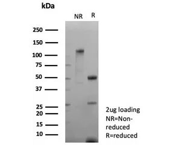 Recombinant NCAM-L1 Antibody / CD171 / L1CAM