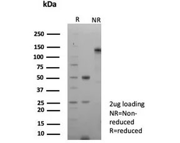 Recombinant Calnexin Antibody