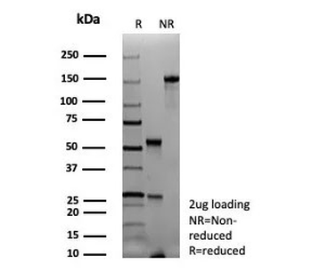 Recombinant PAX6 Antibody / Paired box gene 6