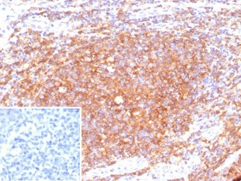 Recombinant CD40 Antibody