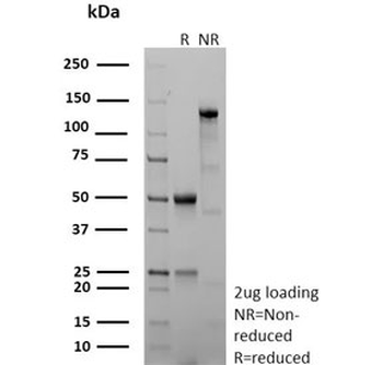 Recombinant CD40 Antibody