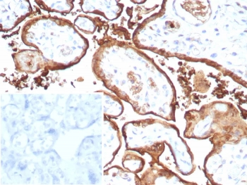 Recombinant MIG9 Antibody / Migration inducing gene 9 / S100P