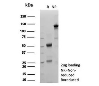 Recombinant MIG9 Antibody / Migration inducing gene 9 / S100P