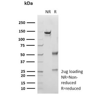 Recombinant S100P Antibody / MIG9