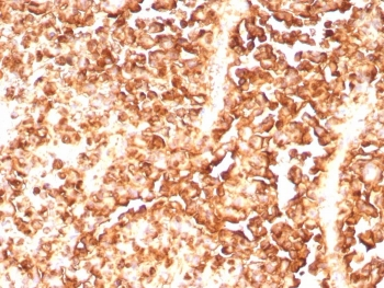 Recombinant S100A1 Antibody