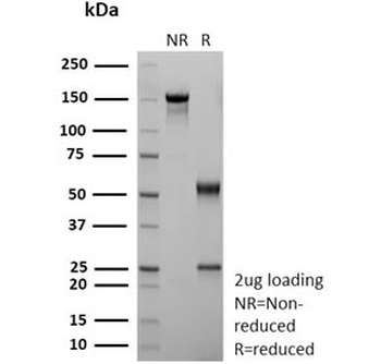 Recombinant CD36 Antibody