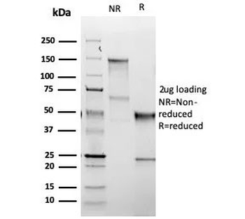 Recombinant TSH Receptor Antibody / B-Chain