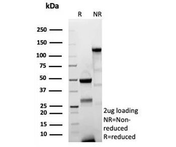 Recombinant CD44v6 Antibody