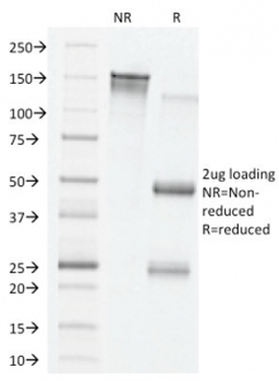 VEGF Antibody / Vascular Endothelial Growth Factor