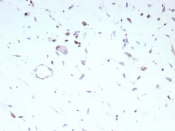 Recombinant Myoblast determination protein 1 Antibody / MyoD1