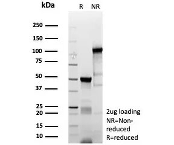 Recombinant Myoblast determination protein 1 Antibody / MyoD1