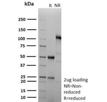 Recombinant Cyclin B1 Antibody