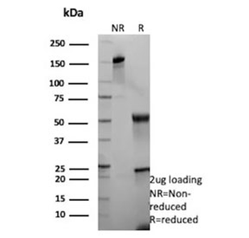 Recombinant KRT13 Antibody / Cytokeratin 13