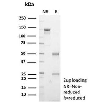 Recombinant E-Cadherin Antibody / CDH1