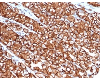 Recombinant Cadherin 1 Antibody / CDH1 / E-Cadherin