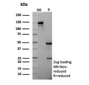 Recombinant Cadherin 1 Antibody / CDH1 / E-Cadherin