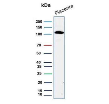 Recombinant E-Cadherin Antibody / CDH1