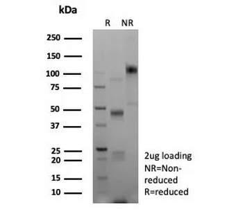 Recombinant E-Cadherin Antibody / CDH1