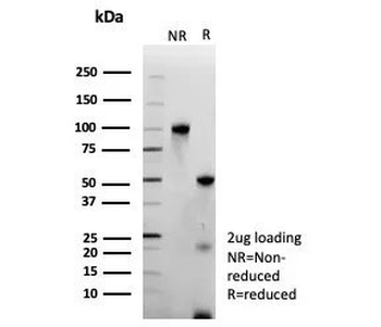 Recombinant Transcriptional Regulator ERG Antibody