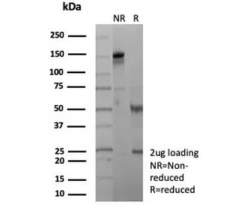 Recombinant CLU Antibody / Clusterin / Apolipoprotein J