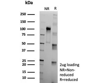 Recombinant Apolipoprotein J Antibody / Clusterin / CLU