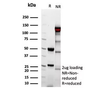Recombinant Complement 4d Antibody / C4d