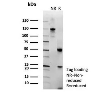 Recombinant LAMP-3 Antibody / CD63