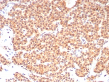 c-RET Antibody / RET