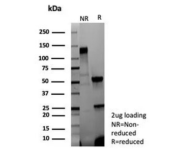Recombinant IVL Antibody / Involucrin
