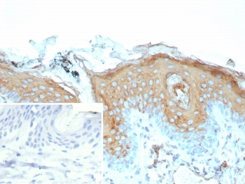 Recombinant IVL Antibody / Involucrin
