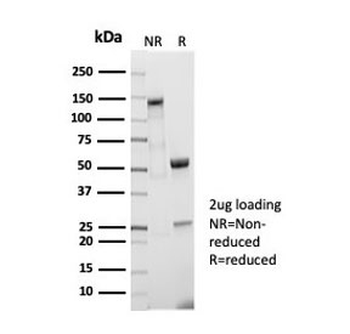 Recombinant CD5 Antibody