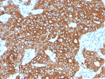 Recombinant CK8/18 Antibody / Cytokeratin 8/18