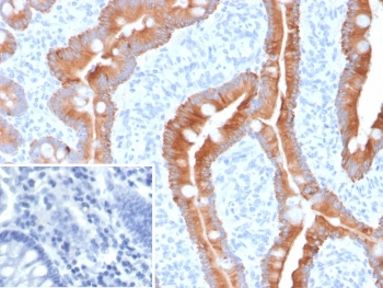 Recombinant CK8/18 Antibody / Cytokeratin 8/18