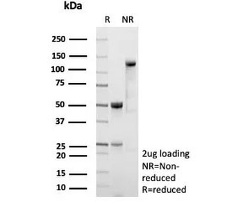 Recombinant CD54 Antibody / ICAM-1